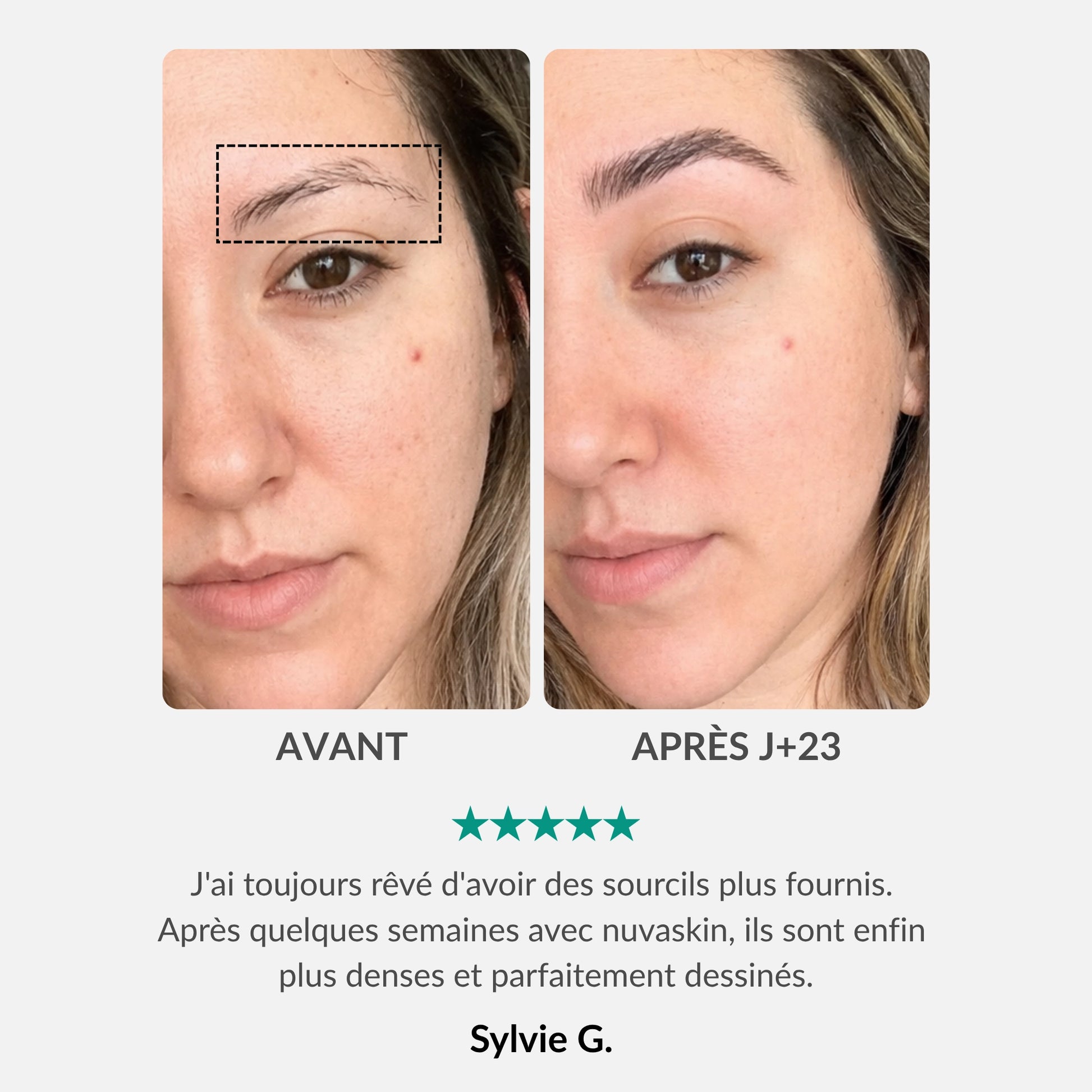 [FR]