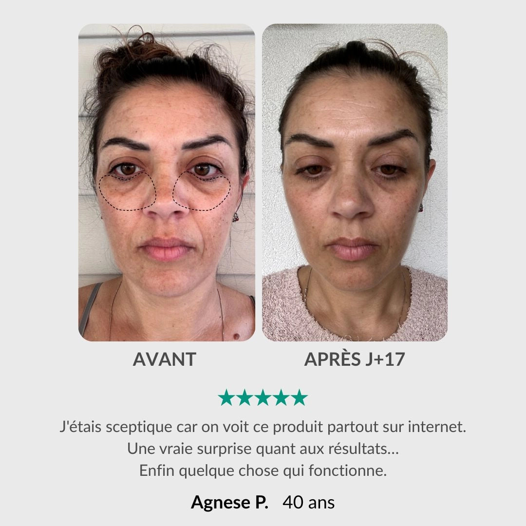 [FR]