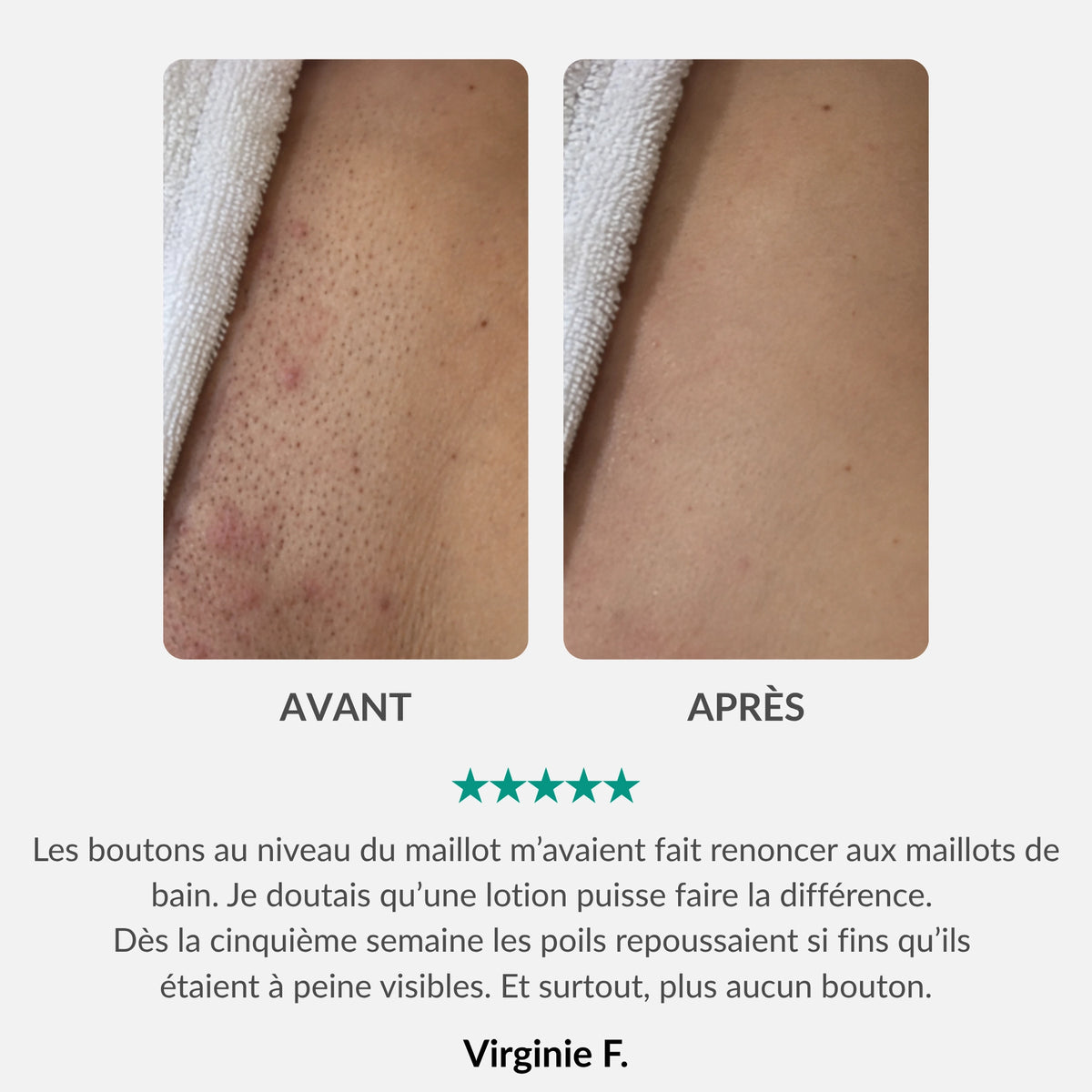 Lotion Botanique Anti-Repousse
