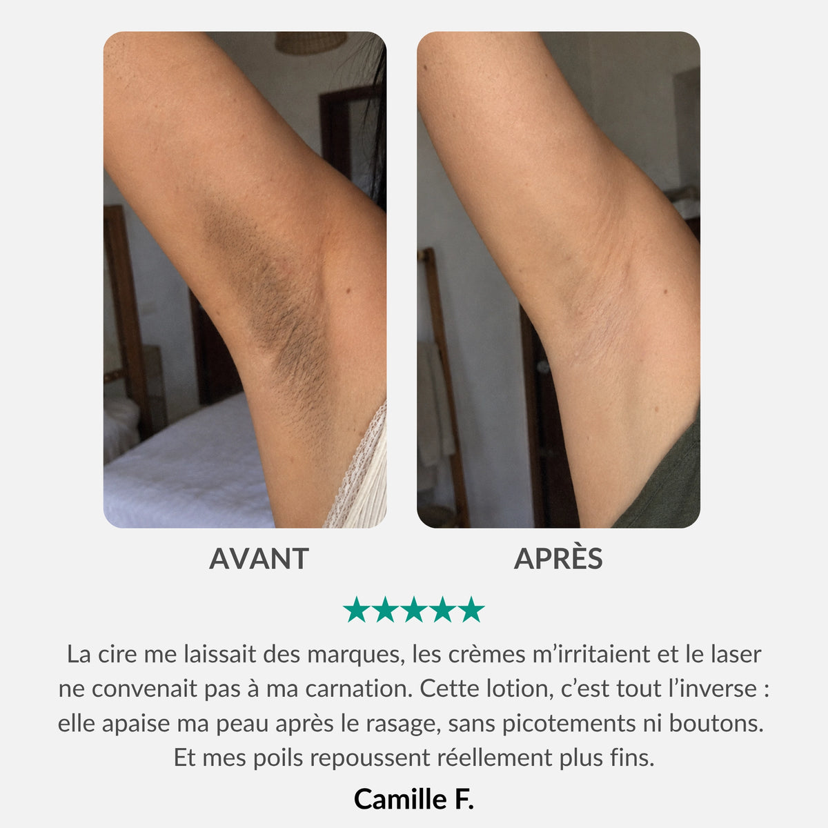 Lotion Botanique Anti-Repousse