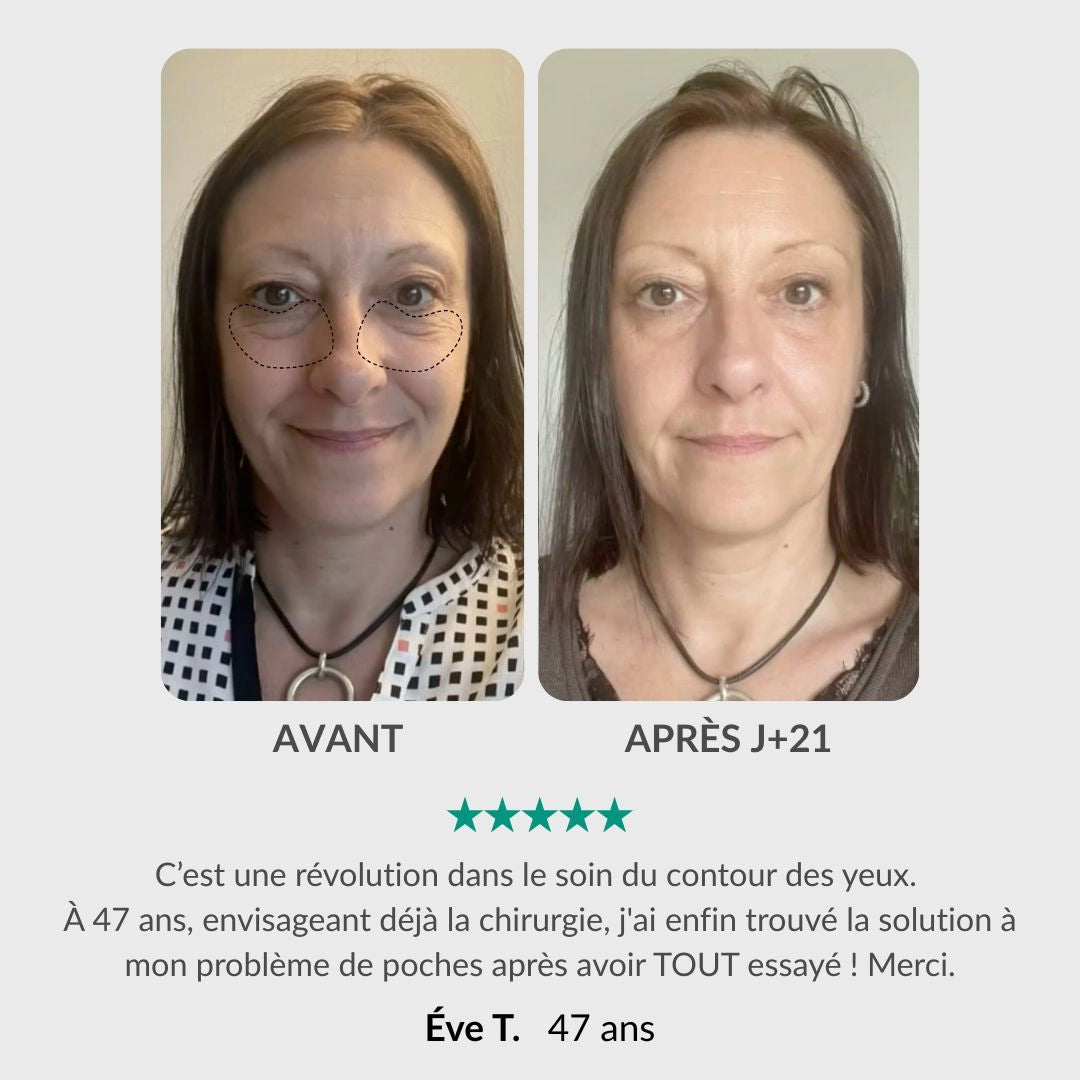 [FR]