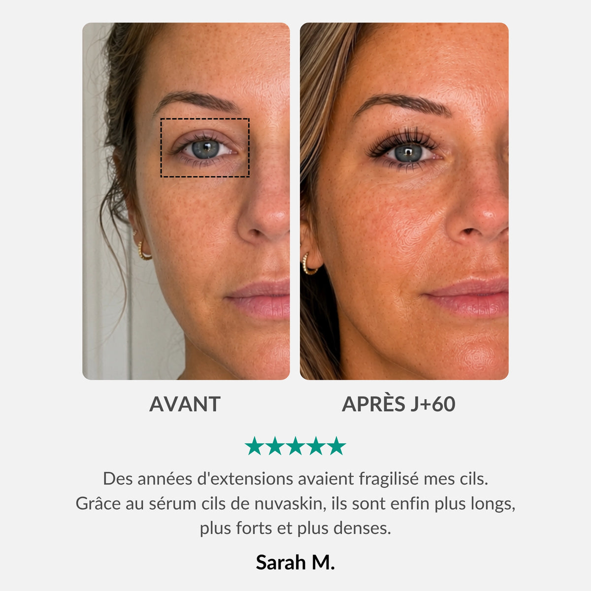 [FR]