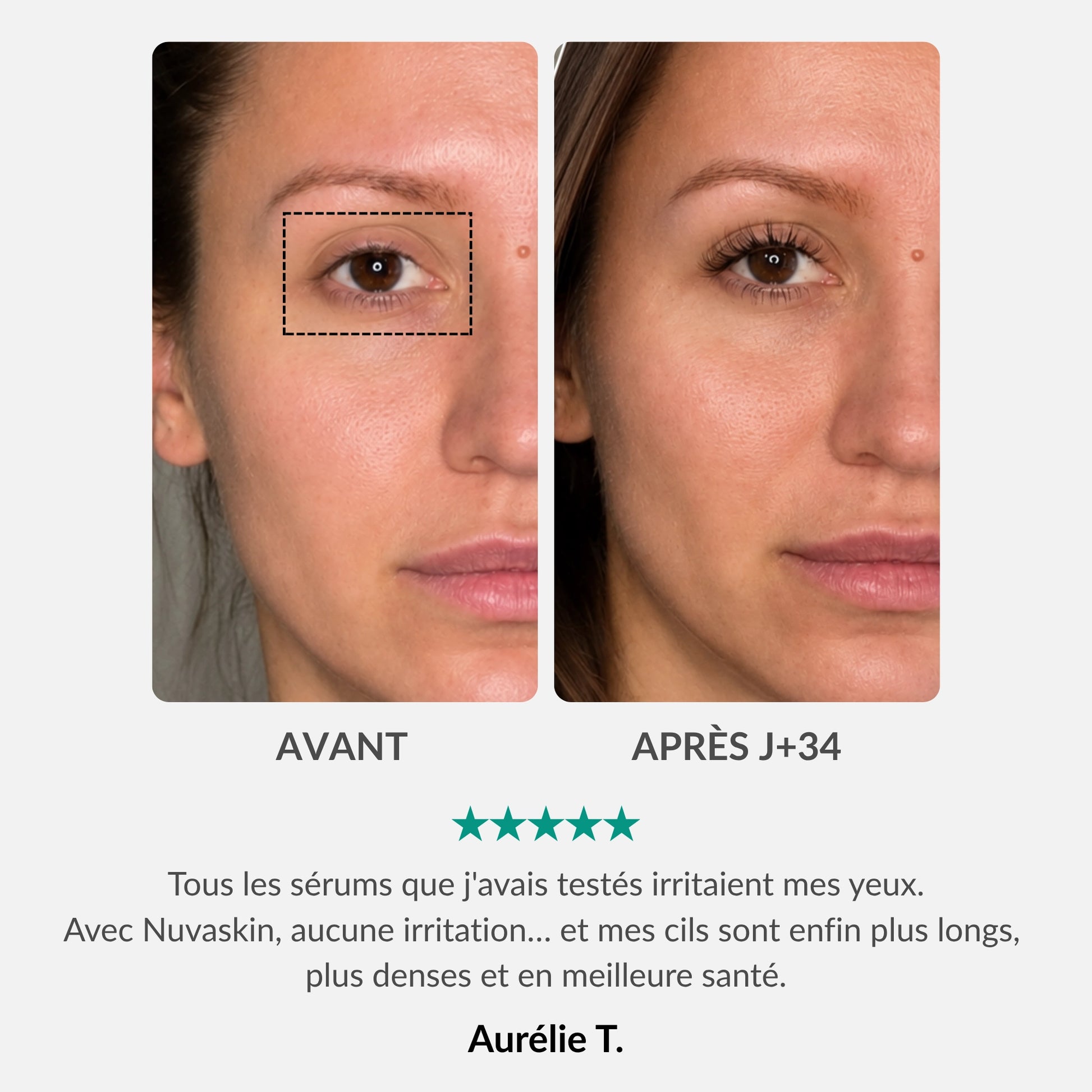 [FR]