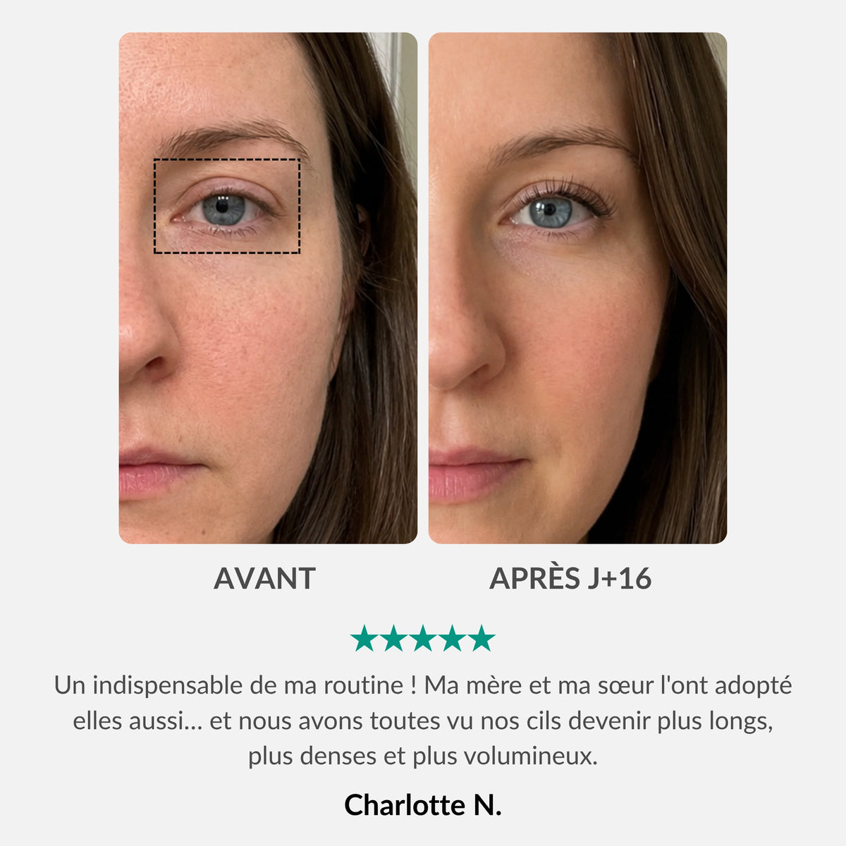 [FR]