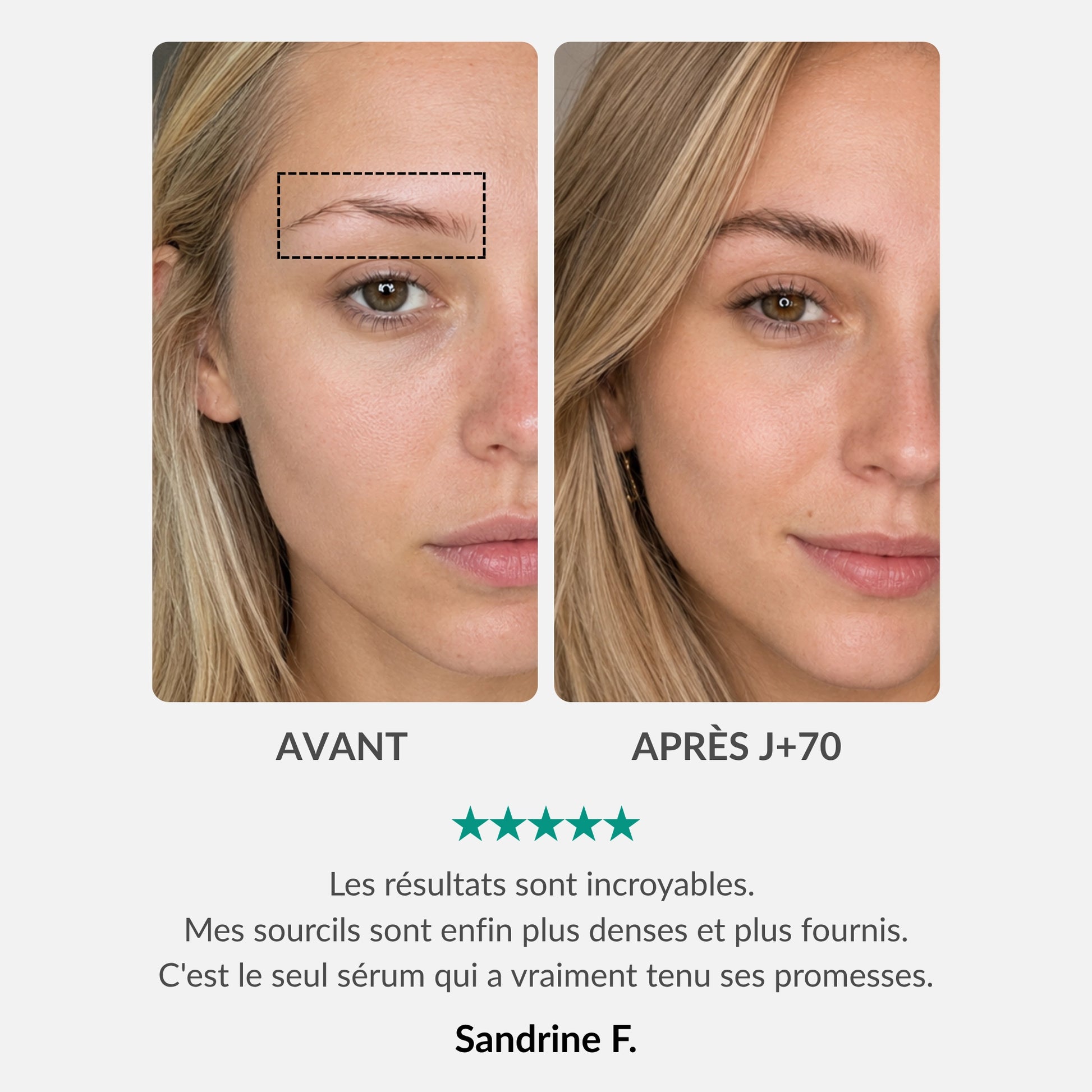[FR]