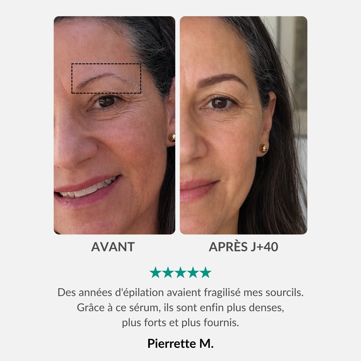 [FR]