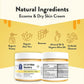 eczema-honey-lifestyle-02-81msp6xb-kl-_ac_sx679.png