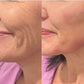 Lingettes Peeling Exfoliantes [FR]