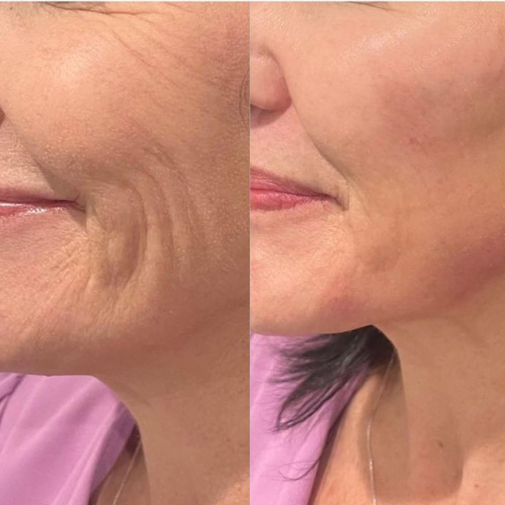 Lingettes Peeling Exfoliantes [FR]