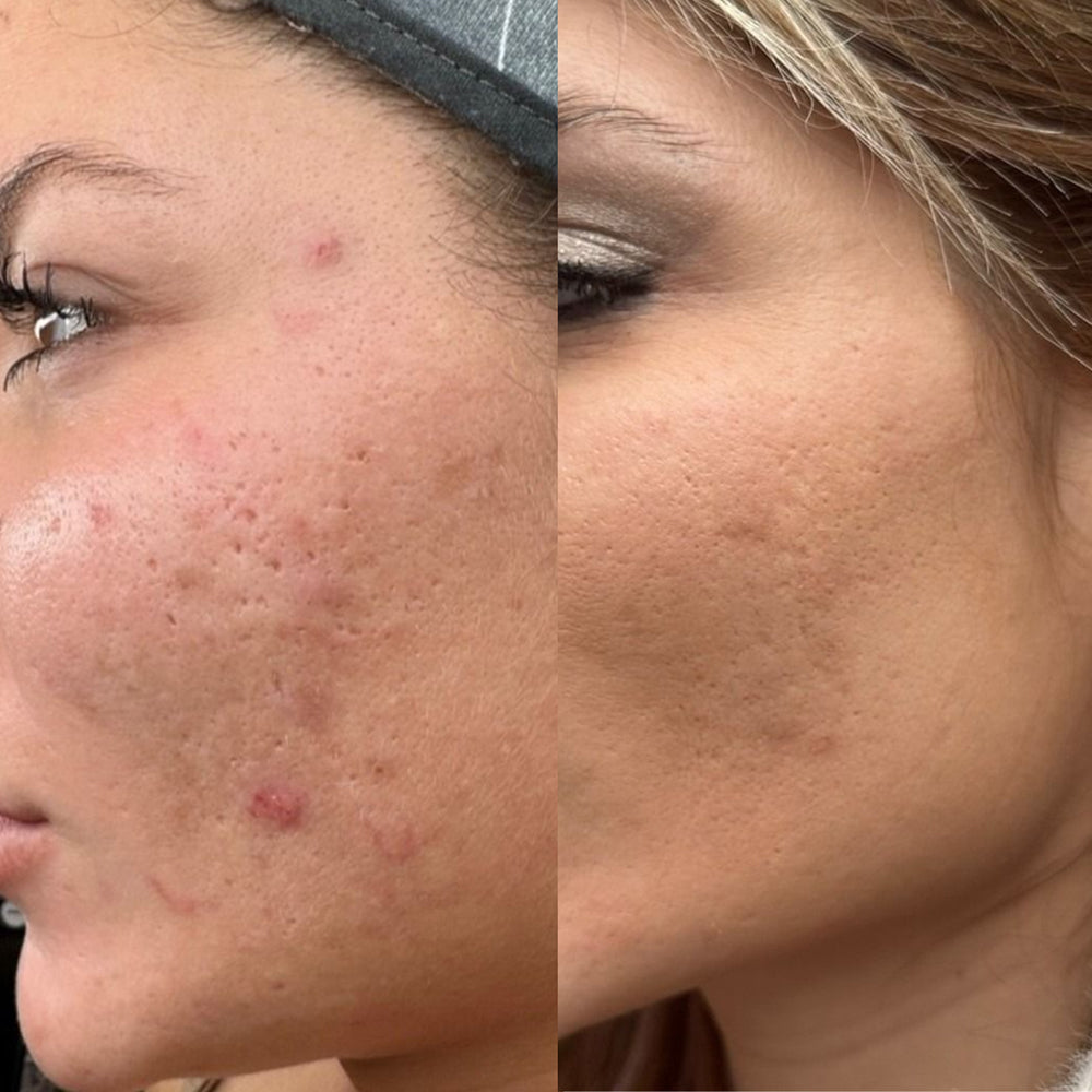 Lingettes Peeling Exfoliantes [FR]