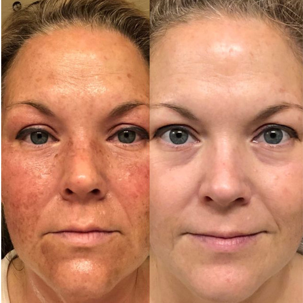 Lingettes Peeling Exfoliantes [FR]