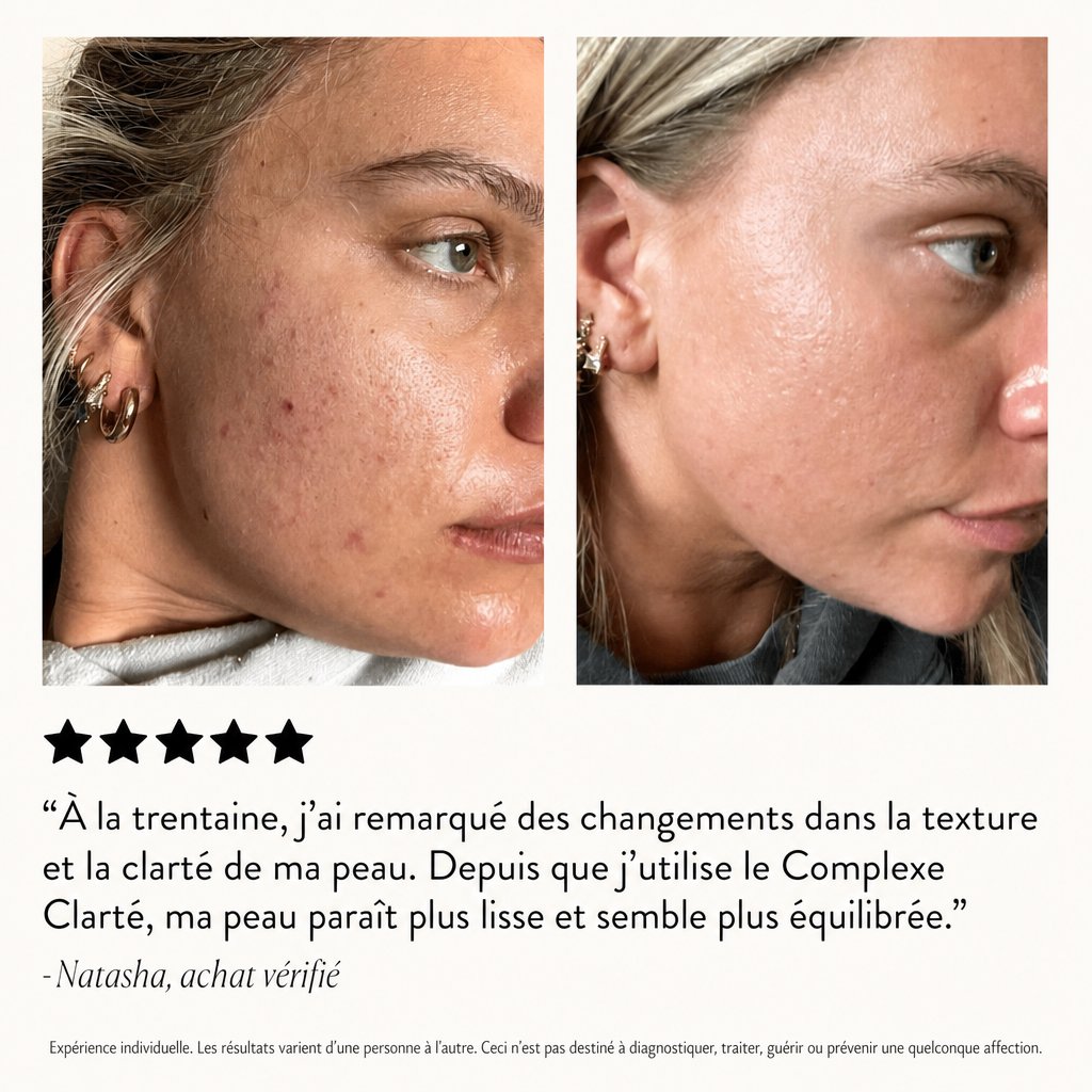 the-skin-clarity-complex-hormonal-breakout-supplement-lifestyle-02-the-skin-clarity-complex-3-month-supply-.png